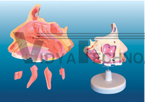 The dissection model of nasal cavity